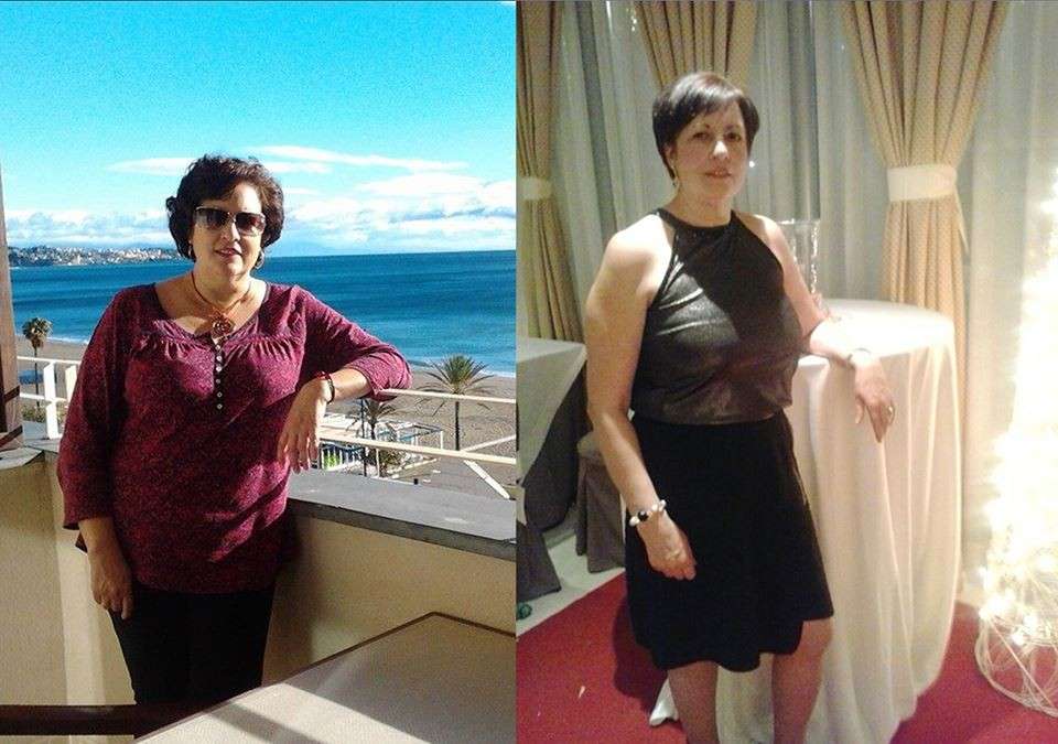 Testimonio del antes y después de un paciente en Pérdida de Peso
